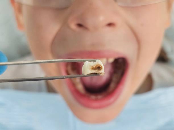 Best Emergency Treatment for Dental Infections or Abscesses in Ramapo College Of New Jersey, NJ